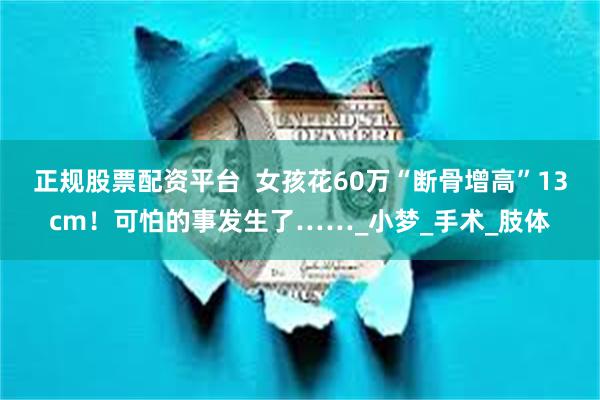 正规股票配资平台  女孩花60万“断骨增高”13cm！可怕的事发生了……_小梦_手术_肢体